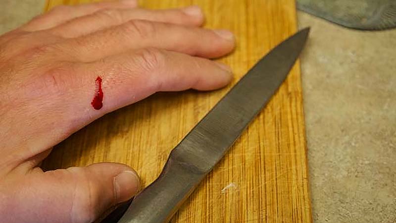 ฝันว่ามีดบาด-เลขเด็ด